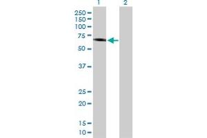 Western Blot analysis of IFNAR1 expression in transfected 293T cell line by IFNAR1 MaxPab polyclonal antibody. (IFNAR1 anticorps  (AA 1-557))