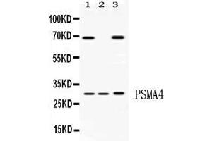 Western blot analysis of PSMA4 expression in rat liver extract ( Lane 1), mouse spleen extract ( Lane 2) and HELA whole cell lysates ( Lane 3). (PSMA4 anticorps  (Middle Region))