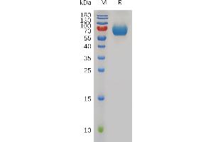 Mouse CD48 Protein, hFc Tag on SDS-PAGE under reducing condition. (CD48 Protein (CD48) (AA 23-217) (Fc Tag))