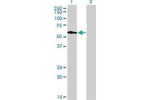 Western Blotting (WB) image for anti-phosphoinositide Kinase, FYVE Finger Containing (PIKFYVE) (AA 342-451) antibody (ABIN566937)