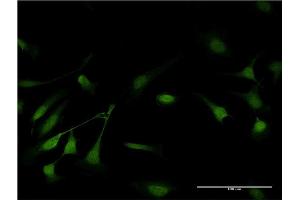 Immunofluorescence of monoclonal antibody to GSTP1 on HeLa cell. (GSTP1 anticorps  (AA 1-210))