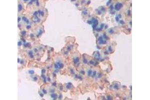 IHC-P analysis of Human Tissue, with DAB staining. (PPOX anticorps  (AA 12-471))