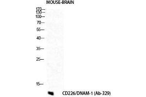 Western Blot (WB) analysis of Mouse Brain cells using DNAM-1 Polyclonal Antibody. (CD226 anticorps  (Tyr570))
