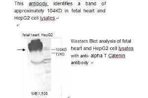 Image no. 1 for anti-Catenin (Cadherin-Associated Protein), alpha 1, 102kDa (CTNNA1) antibody (ABIN790787) (CTNNA1 anticorps)
