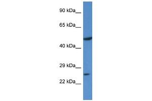 Western Blotting (WB) image for anti-Kruppel-Like Factor 17 (KLF17) (N-Term) antibody (ABIN405290) (KLF17 anticorps  (N-Term))