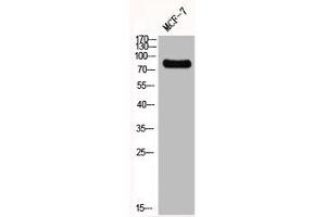 Western Blot analysis of MCF7 cells using GIT2 Polyclonal Antibody (GIT2 anticorps  (Internal Region))