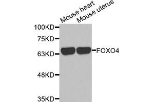 Western Blotting (WB) image for anti-Forkhead Box O4 (FOXO4) antibody (ABIN1872735) (FOXO4 anticorps)