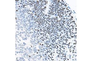 Immunohistochemistry of paraffin-embedded mouse fetal Brain using SOX2 Rabbit pAb (ABIN6130648, ABIN6148295, ABIN6148297 and ABIN6215241) at dilution of 1:100 (40x lens). (SOX2 anticorps  (AA 1-140))
