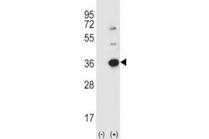 Western blot analysis using anti-Caspase-3 antibody and 293 cell lysate (2 ug/lane) either nontransfected (Lane 1) or transiently transfected (2) with the CASP3 gene. (Caspase 3 anticorps  (AA 60-90))