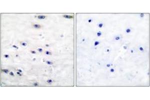 Immunohistochemistry analysis of paraffin-embedded human brain tissue, using Tyrosine Hydroxylase (Ab-19) Antibody. (Tyrosine Hydroxylase anticorps  (AA 10-59))