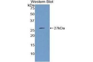 Detection of Recombinant CTH, Mouse using Polyclonal Antibody to Cystathionine (CTH) (Cystathionine (AA 14-224) anticorps)