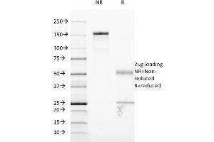 SDS-PAGE Analysis Purified CD54 Monoclonal Antibody (W-CAM-1). (ICAM1 anticorps)