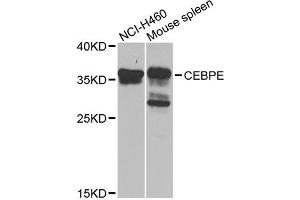 Western blot analysis of extracts of various cell lines, using CEBPE antibody (ABIN5975692) at 1/1000 dilution. (CEBPE anticorps)