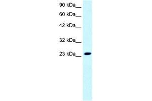 WB Suggested Anti-FLJ11730 Antibody Titration: 0. (FLJ11730 (N-Term) anticorps)