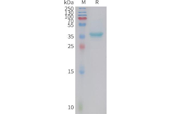 GAL Protein (AA 20-123) (Fc Tag)