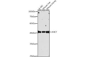 Western blot analysis of extracts of various cell lines, using AHCY antibody (ABIN1680618, ABIN1680617, ABIN7101497 and ABIN7101498) at 1:1000 dilution. (AHCY anticorps)