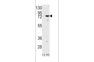 Western blot analysis of PKC delta using rabbit polyclonal PKC delta Antibody using 293 cell lysates (2 ug/lane) either nontransfected (Lane 1) or transiently transfected with the PRKCD gene (Lane 2). (PKC delta anticorps  (N-Term))