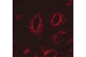 Immunocytochemistry/Immunofluorescence analysis using Mouse Anti-LAMP1 Monoclonal Antibody, Clone Ly1C6 . (LAMP1 anticorps  (PerCP))