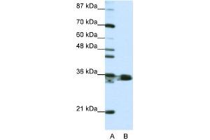 WB Suggested Anti-HNRPA1 Antibody Titration:  1. (HNRNPA1 anticorps  (N-Term))