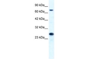 Western Blotting (WB) image for anti-Minichromosome Maintenance Complex Component 6 (MCM6) antibody (ABIN2461394) (MCM6 anticorps)