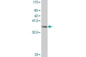 Western Blot detection against Immunogen (39. (SMAD3 anticorps  (AA 147-270))