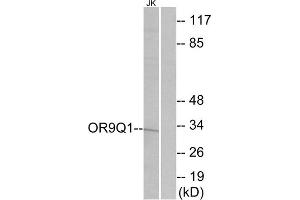 Western blot analysis of extracts from Jurkat cells, using OR9Q1 antibody. (OR9Q1 anticorps  (C-Term))