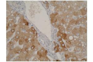 Staining using CYP2A6 antibody on normal human liver tissue at 1 µg/ml. (CYP2A6 anticorps  (C-Term))