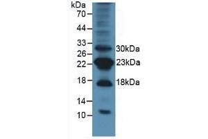 Detection of Surv in Mouse Lung Tissue using Polyclonal Antibody to Survivin (Surv) (Survivin anticorps  (AA 1-140))