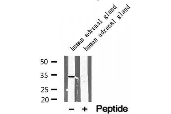 SULT1E1 anticorps  (Internal Region)