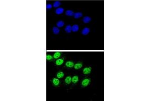 Confocal immunofluorescent analysis of BAG1 Antibody (C-term) (ABIN389451 and ABIN2839520) with Hela cell followed by Alexa Fluor® 488-conjugated goat anti-rabbit lgG (green). (BAG1 anticorps  (C-Term))