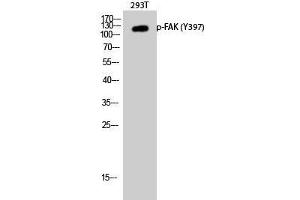 Western Blot analysis of 293T cells with Phospho-FAK (Tyr397) Polyclonal Antibody at dilution of 1:1000 (FAK anticorps  (pTyr397))