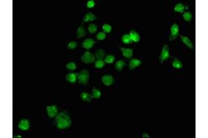 Immunofluorescence staining of PC-3 cells with ABIN7163013 at 1:100, counter-stained with DAPI. (PPARG anticorps  (AA 1-477))