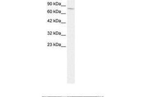 Image no. 2 for anti-Endoglin (ENG) (AA 61-110) antibody (ABIN202837) (Endoglin anticorps  (AA 61-110))