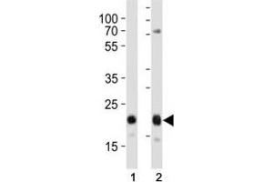 Western blot analysis of lysate from (1) HeLa and (2) MCF-7 cell line using CD9 antibody at 1:1000. (CD9 anticorps  (AA 115-145))