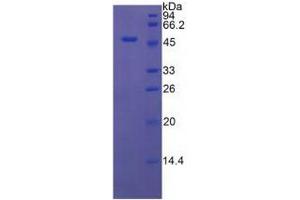 SDS-PAGE analysis of Rat MCP Protein. (CD46 Protein (CD46))