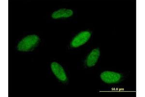 Immunofluorescence of purified MaxPab antibody to RBM23 on HeLa cell. (RBM23 anticorps  (AA 1-424))