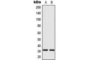 Western blot analysis of MRPL24 expression in HeLa (A), HepG2 (B) whole cell lysates. (MRPL24 anticorps  (Center))