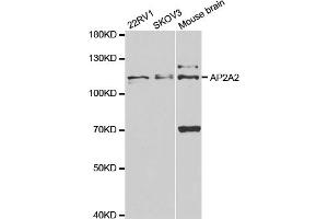 Western blot analysis of extracts of various cell lines, using AP2A2 antibody (ABIN5973124) at 1/1000 dilution. (AP2A2 anticorps)