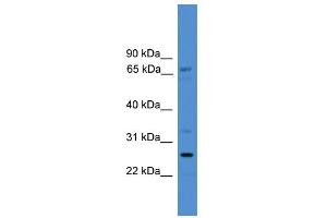 WB Suggested Anti-SLC13A3 Antibody Titration:  0. (SLC13A3 anticorps  (C-Term))