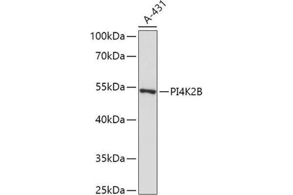 PI4K2B anticorps  (AA 1-120)