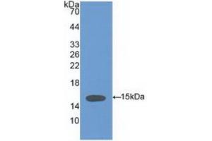 Detection of Recombinant VCL, Human using Polyclonal Antibody to Vinculin (VCL) (Vinculin anticorps  (AA 1020-1134))