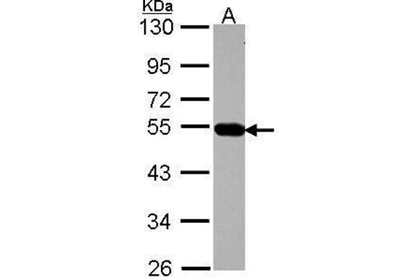 AP4M1 anticorps  (Center)