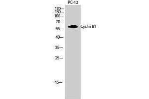Western Blotting (WB) image for anti-Cyclin B1 (CCNB1) (Ser126) antibody (ABIN3174614) (Cyclin B1 anticorps  (Ser126))