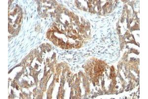 Image no. 2 for anti-Vascular Endothelial Growth Factor A (VEGFA) antibody (ABIN6168158) (VEGFA anticorps)