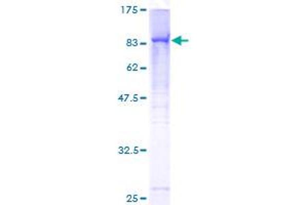 RECQL4 Protein (AA 1-652) (GST tag)