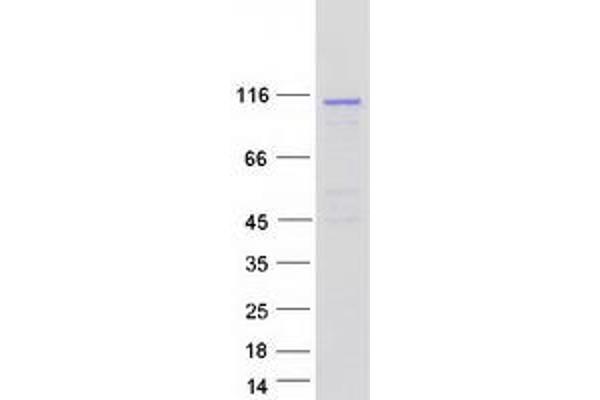 FUK Protein (Myc-DYKDDDDK Tag)