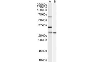 Western Blotting (WB) image for anti-Pre-mRNA Processing Factor 31 (PRPF31) (Internal Region) antibody (ABIN2466149) (PRPF31 anticorps  (Internal Region))