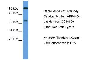 WB Suggested Anti-Ece2  Antibody Titration: 0. (ECE2 anticorps  (Middle Region))