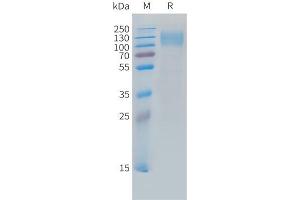 Cynomolgus CEA Protein, His Tag on SDS-PAGE under reducing condition. (CEACAM5 Protein (AA 35-685) (His tag))