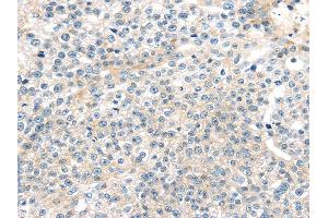 Immunohistochemistry (IHC) image for anti-Tumor Necrosis Factor, alpha-Induced Protein 8 (TNFAIP8) antibody (ABIN5958018) (TNFAIP8 anticorps)